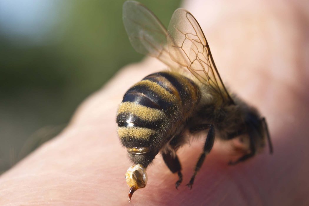 bee sting allergies e1563353107132